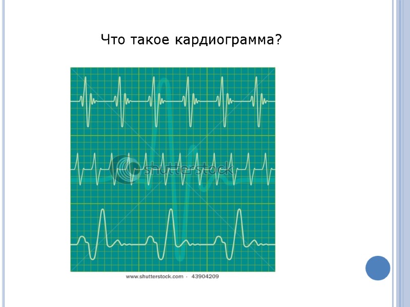 Что такое кардиограмма?